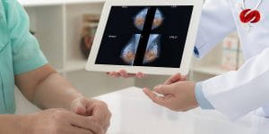 FDA aprueba el uso de atezolizumab para el cáncer de mama triple negativo