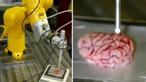 Crean Bisturí que permite detectar tumores cerebrales