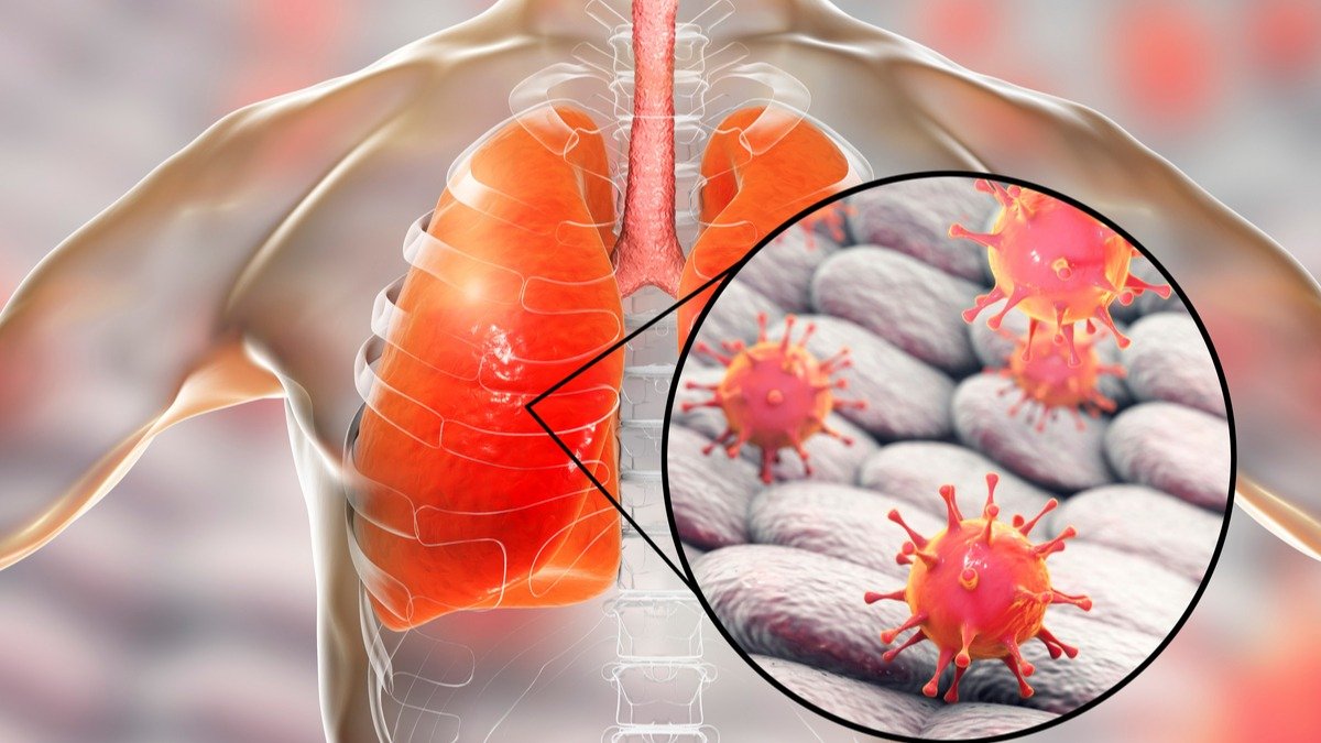 Antibióticos debilitan las defensas de la gripe en el pulmón: Estudio