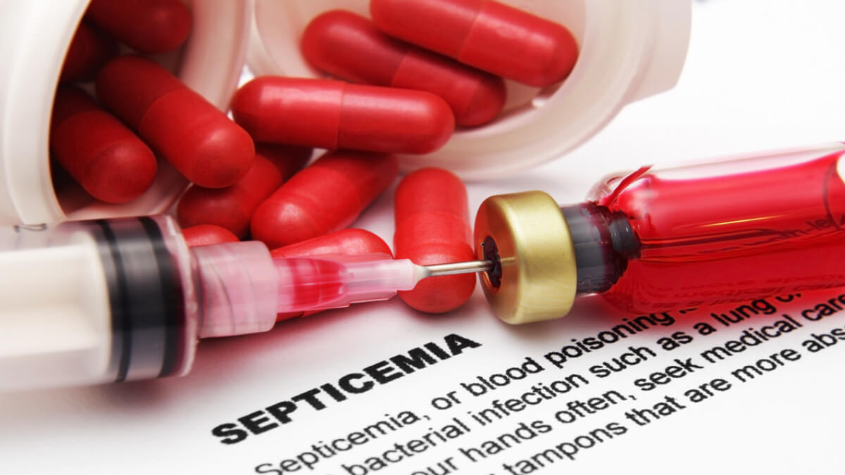 Investigación revela aumento de la septicemia en los últimos años