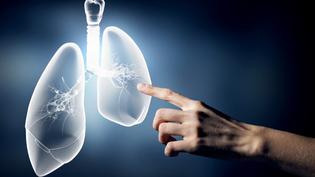 Se expande el registro INVIMA de osimertinib para primera línea de cáncer de pulmón EGFR mutado