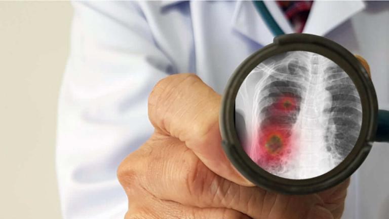 Directrices para la atención temprana del coronavirus