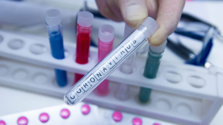 Empresas farmacéuticas piden acelerar la búsqueda de cura del coronavirus