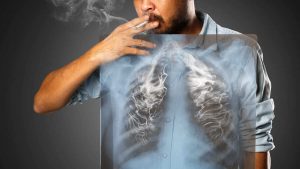 ¿Cómo afecta el humo el ADN de las células pulmonares normales