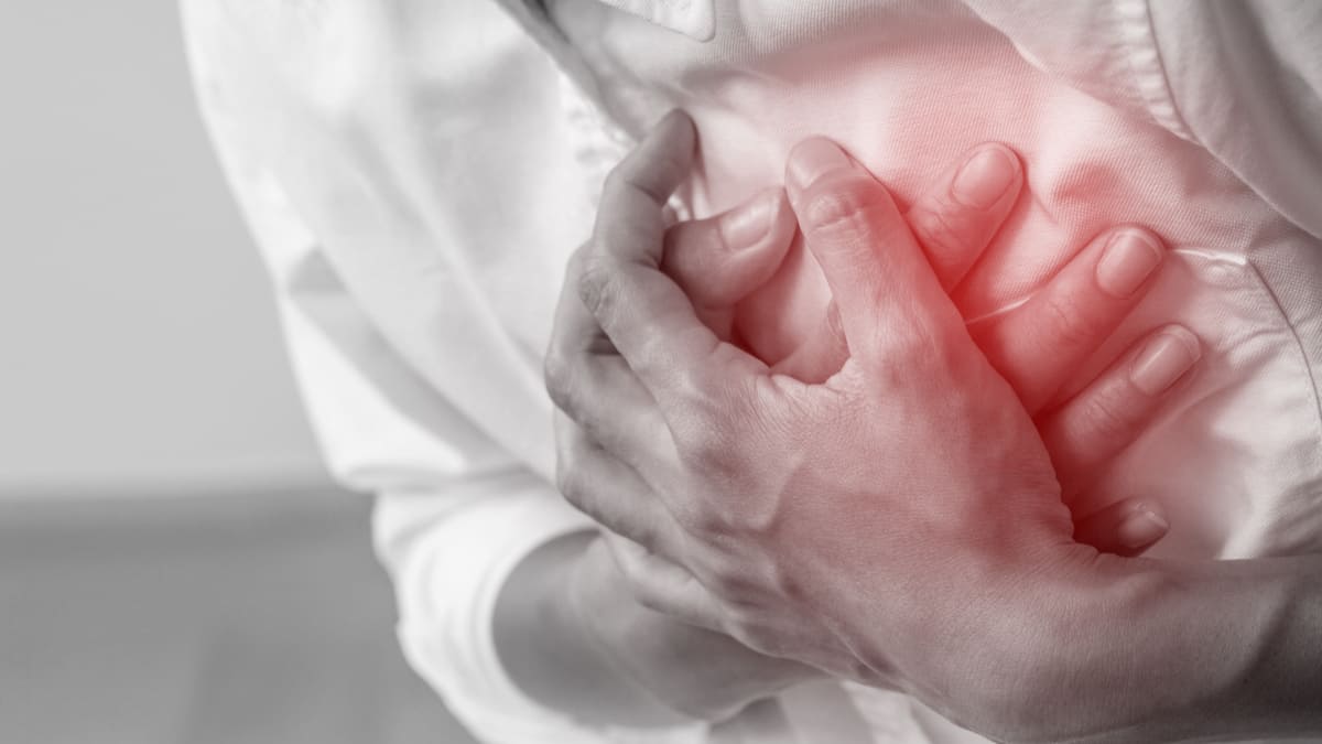 Breve estudio descriptivo del infarto agudo de miocardio en Colombia entre 2015 y 2019