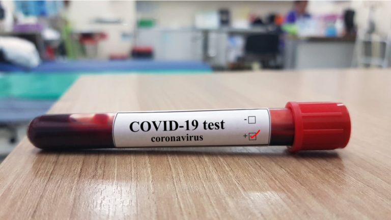 Invima alerta anuncios fraudulentos sobre pruebas para covid-19