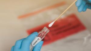 Uso y utilidad de las pruebas para coronavirus