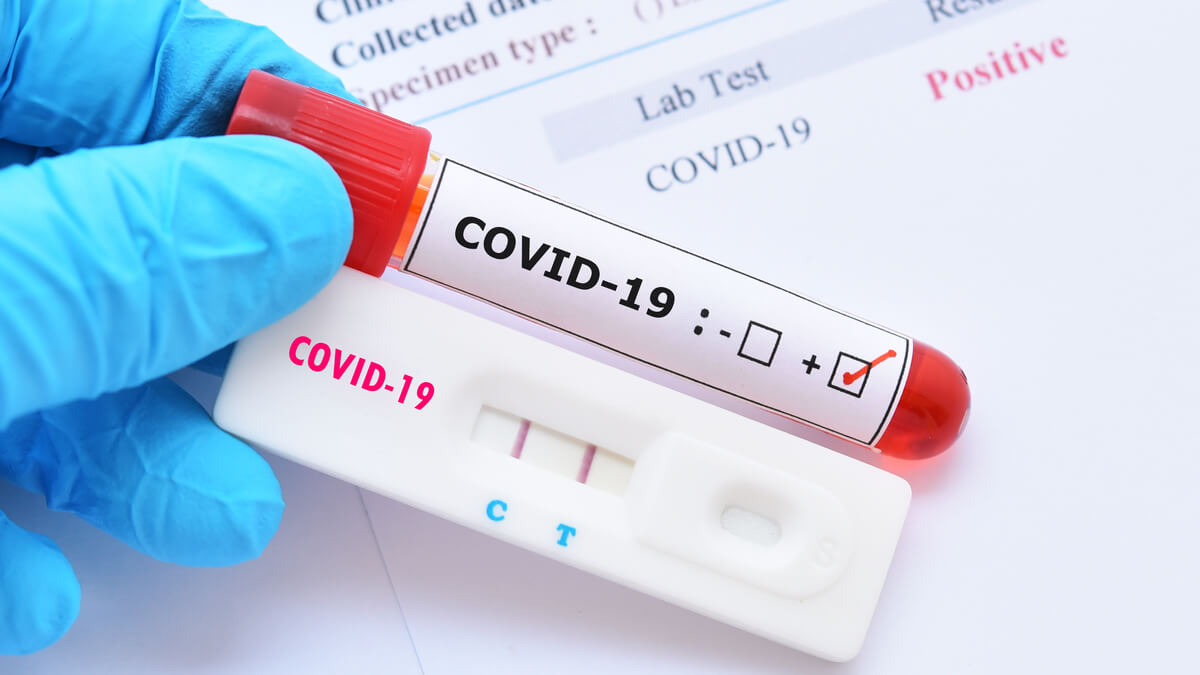Invima advierte sobre el uso de pruebas rápidas para detectar el Covid-19