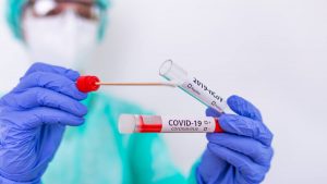 Más de 15 mil resultados de pruebas Covid-19 no se han entregado