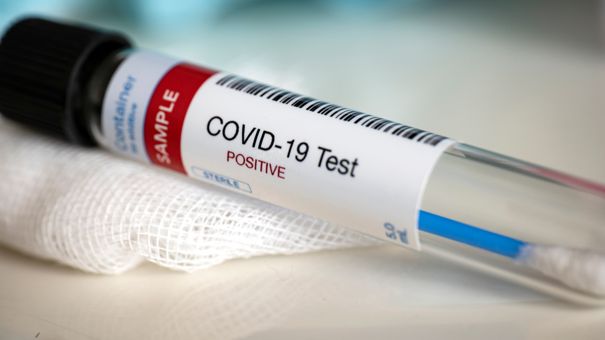 Optimizado el sistema de diagnóstico de Covid-19 en la capital