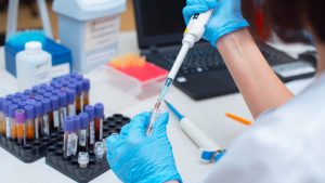 Investigadores revelan primer caso de VIH que resiste antirretrovirales