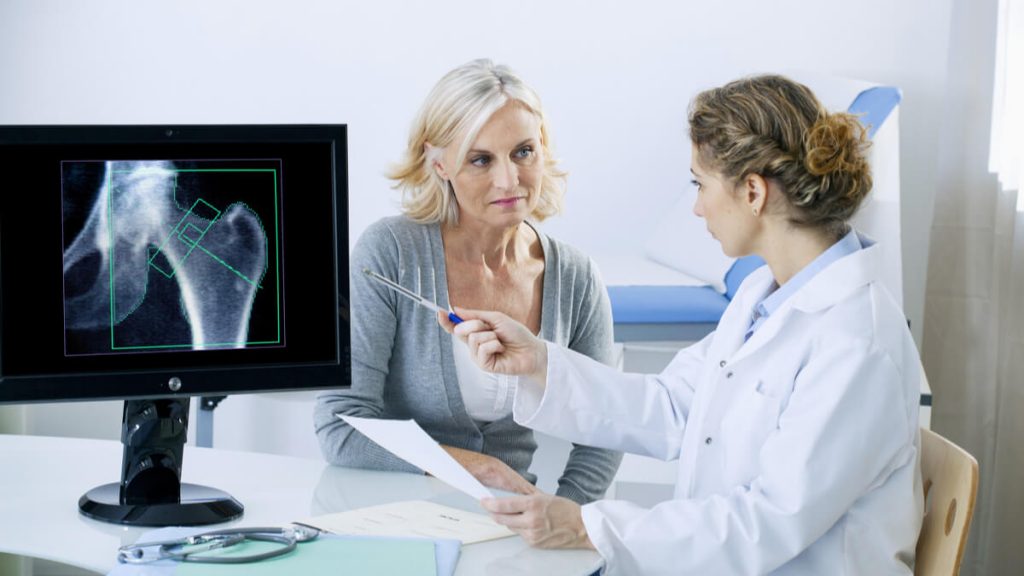 Menopausia aumenta el riesgo de sufrir osteoporosis