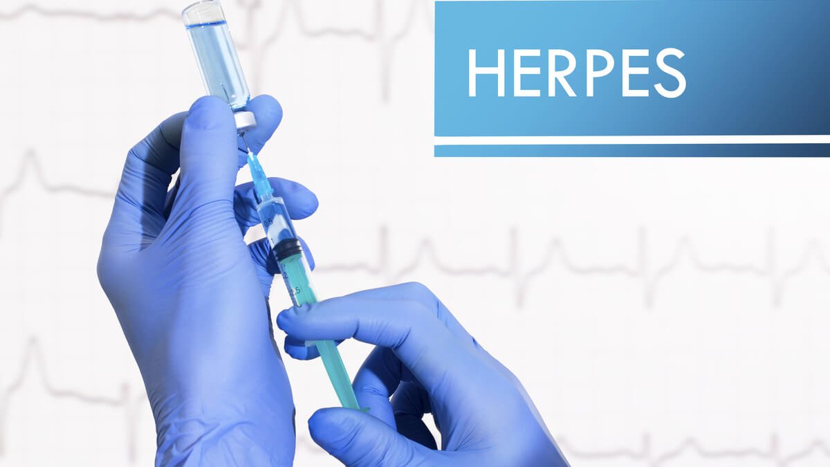 Desarrollan nuevo tratamiento para el herpes en Suecia
