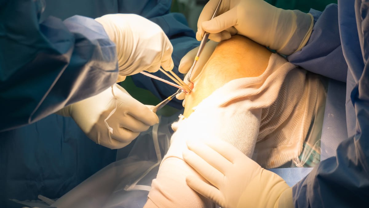 UIS crea dispositivo para cirugias de ligamento cruzado