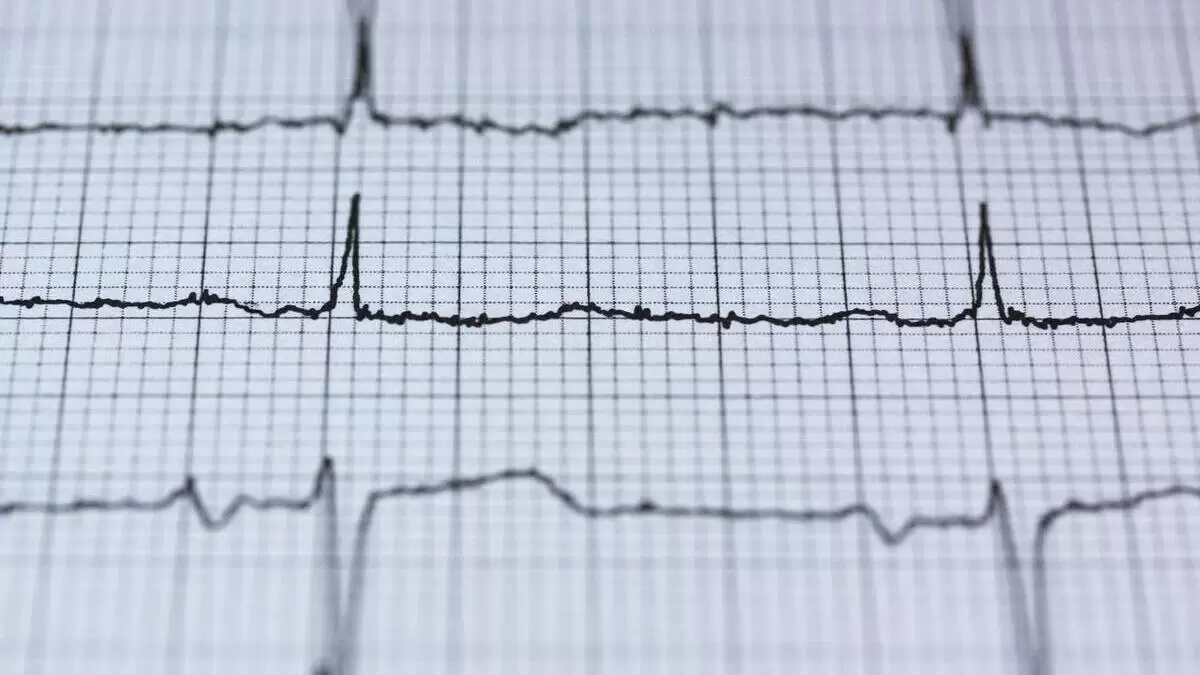 cambian tasas muerte prematura nivel mundial