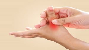 Aprueban en Europa guselkumab para la artritis psoriásica activa
