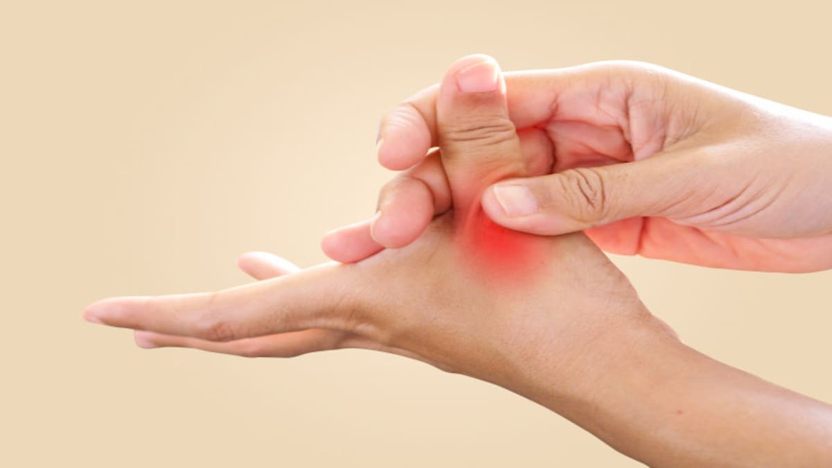 Aprueban Guselkumab Para La Artritis Psoriasica Activa En Europa