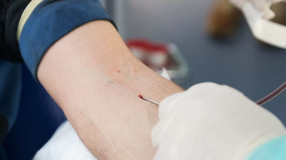 Drepanocitosis anemia 2020