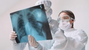 Mas de 900 personas riesgo tuberculosis Peru