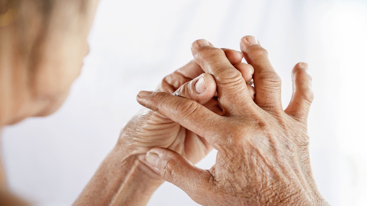 Artritis Reumatoide Medicamento En Pruebas Muestra Efectividad En Su Tratamiento