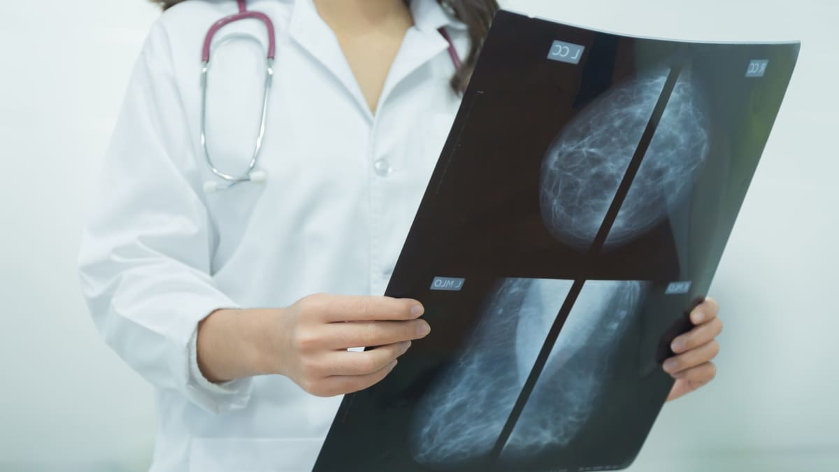 Estudio muestra los beneficios de las mamografías de control
