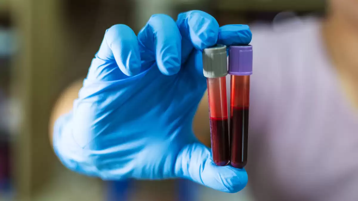 abece de la hemofilia en Colombia