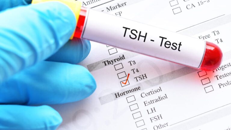 metodo no invasivo medir hormona tiroidea tejidos