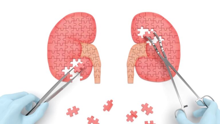 El síndrome nefrótico provoca un alto riesgo de insuficiencia renal