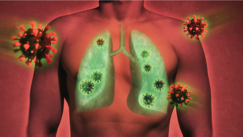 Metformina podría disminuir inflamación pulmonar por Covid-19