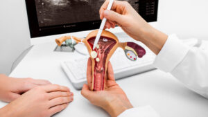 Transferencia de microbiota vaginal ayudaría a tratar la vaginitis