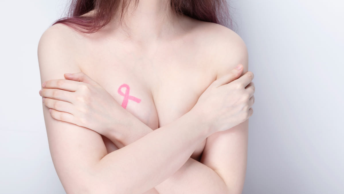 CAC panorama del cáncer de mama en Colombia 2020