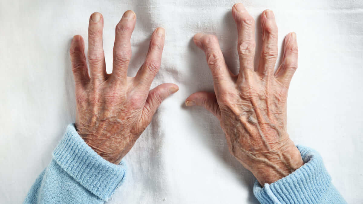 Científicos están desarrollando una vacuna experimental para la artritis reumatoide