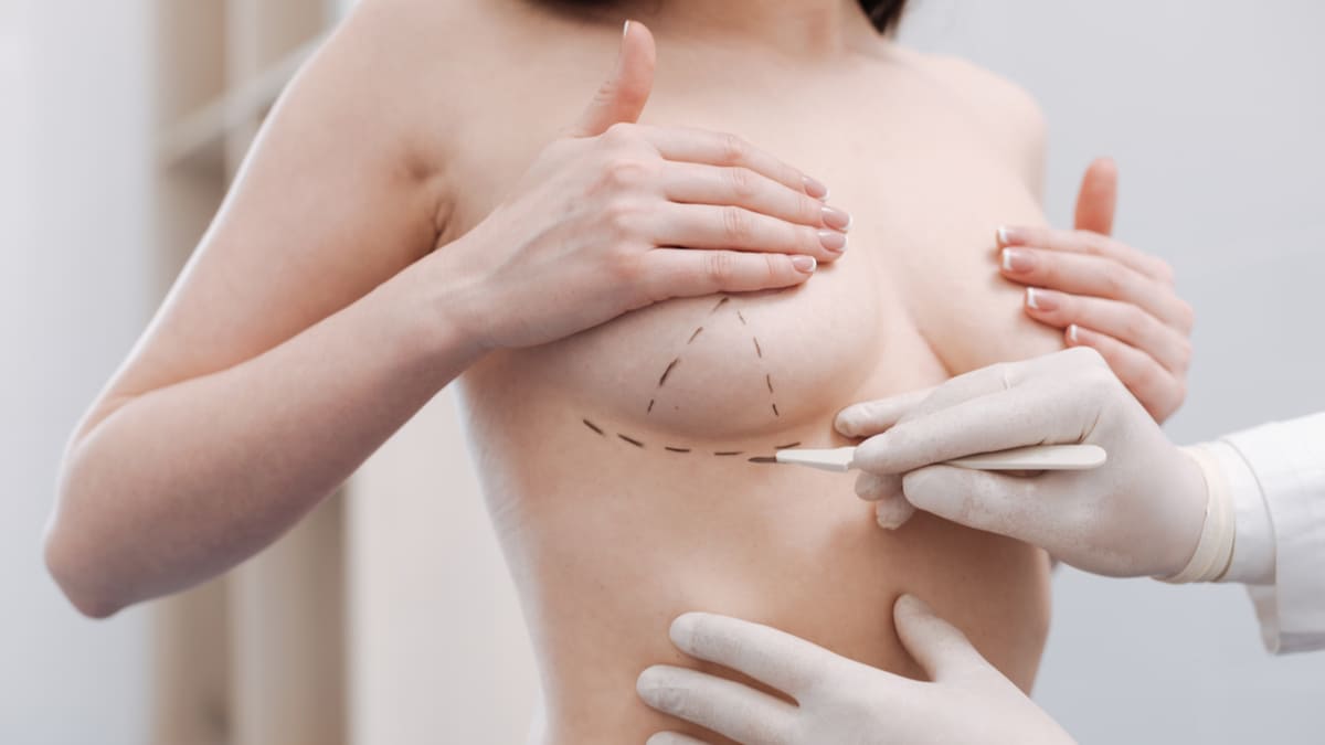 FDA actualización de requisitos y riesgos de los implantes mamarios