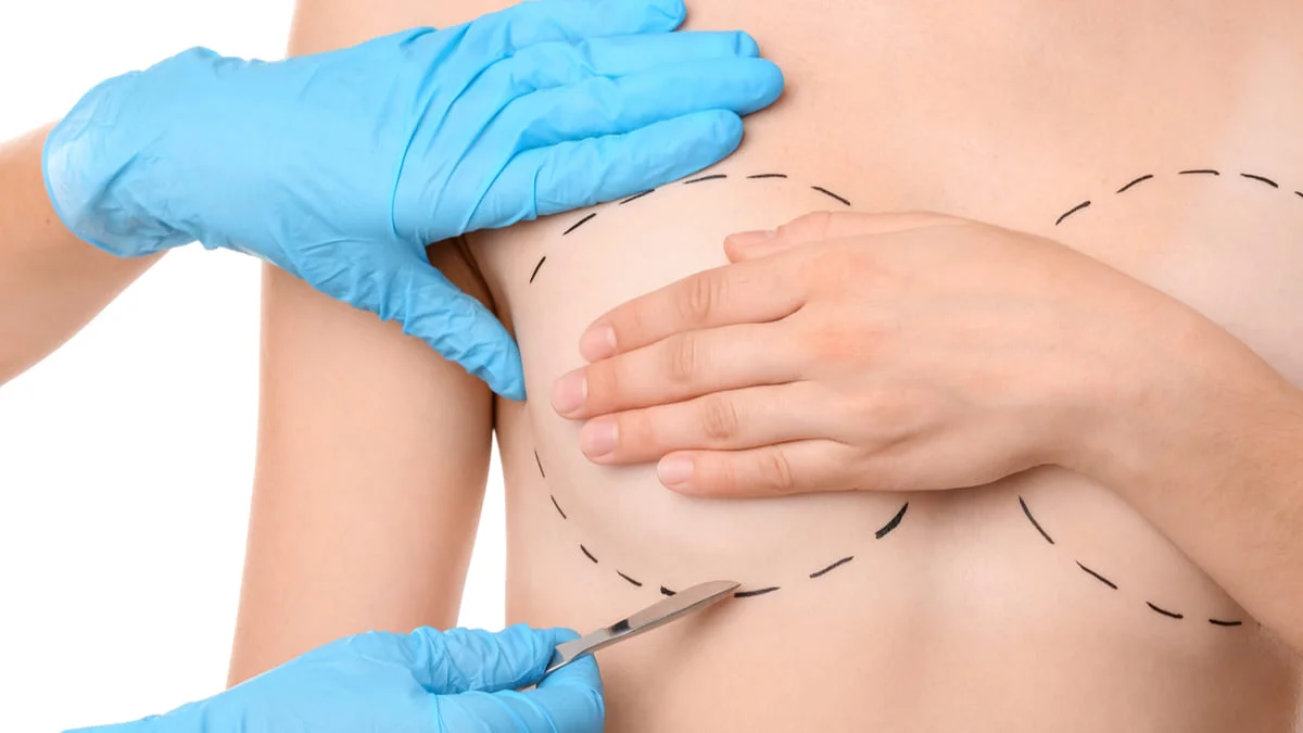 Ley 2194 de 2022 - Eliminación de barreras para el tratamiento del cáncer de mama aprueban reconstrucción de ambos senos