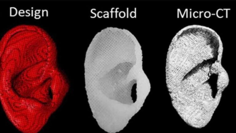 crean tecnologia implantes auriculares biodegradables. Foto Biofabrication