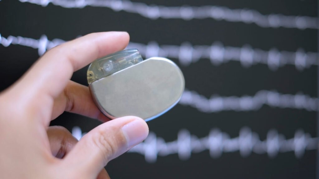 Interferencia magnética, el riesgo poco explorado de los dispositivos implantables