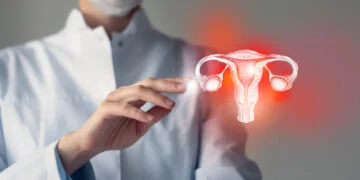 Crean nanopartículas capaces de localizar y eliminar lesiones de endometriosis 20 Crean nanopartículas capaces de localizar y eliminar lesiones de endometriosis