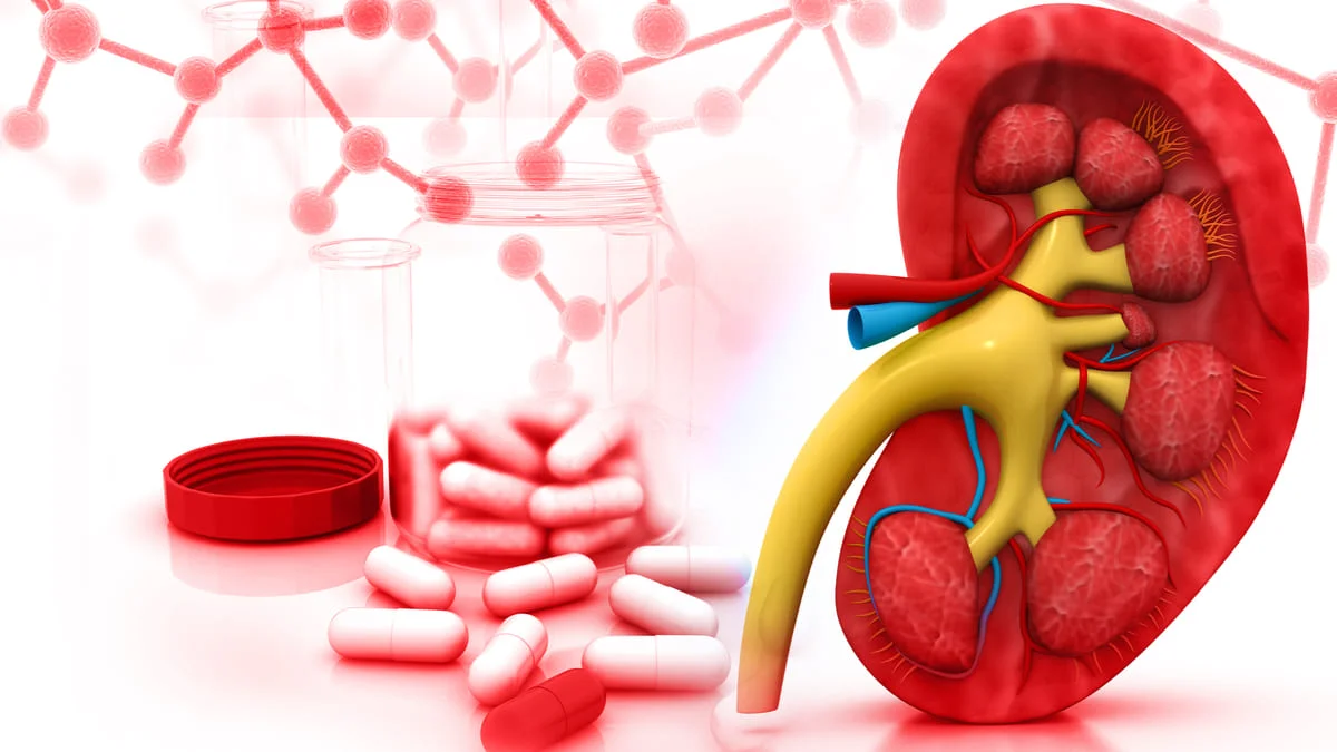Inhibidores SGLT-2 y la reducción del riesgo de cálculos renales en pacientes con diabetes tipo 2 ¿un nuevo beneficio