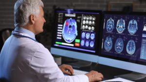 FDA autoriza método diagnóstico para alzhéimer en fase temprana