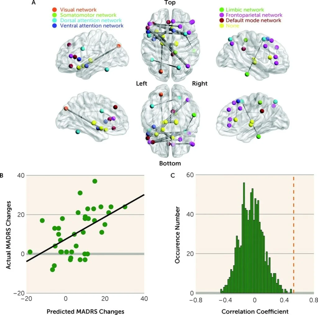 Mapa del cerebro tratamiento depresion11