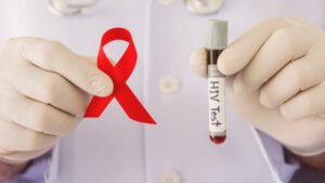 Sistemas de salud no están listos para el envejecimiento de los pacientes con VIH