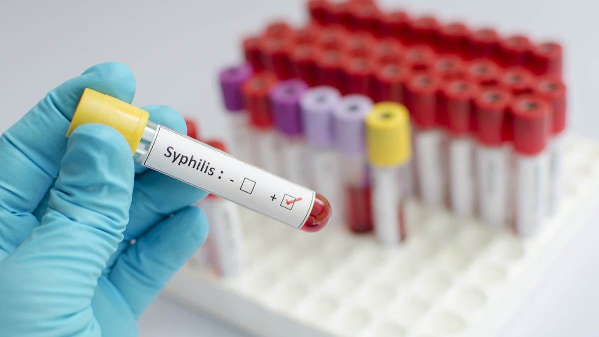Cerca de 5 millones de personas han sido diagnosticados con sífilis en la región OPS