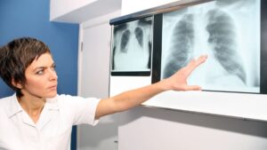 Hipertensión Pulmonar Guía de diagnóstico y tratamiento
