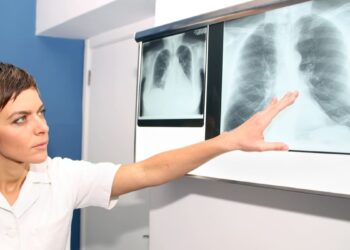 Hipertensión Pulmonar Guía de diagnóstico y tratamiento
