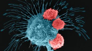 Bioimpresión en 3D de tumores de cáncer de mama para testear tratamientos