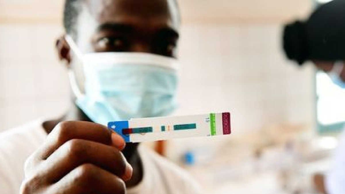 En 2021 se registraron 1.5 millones de nuevas infecciones de VIH ONUSIDA