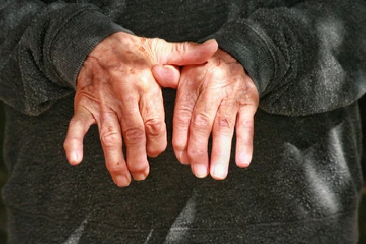 Mujeres, más afectadas por artritis reumatoide en Colombia