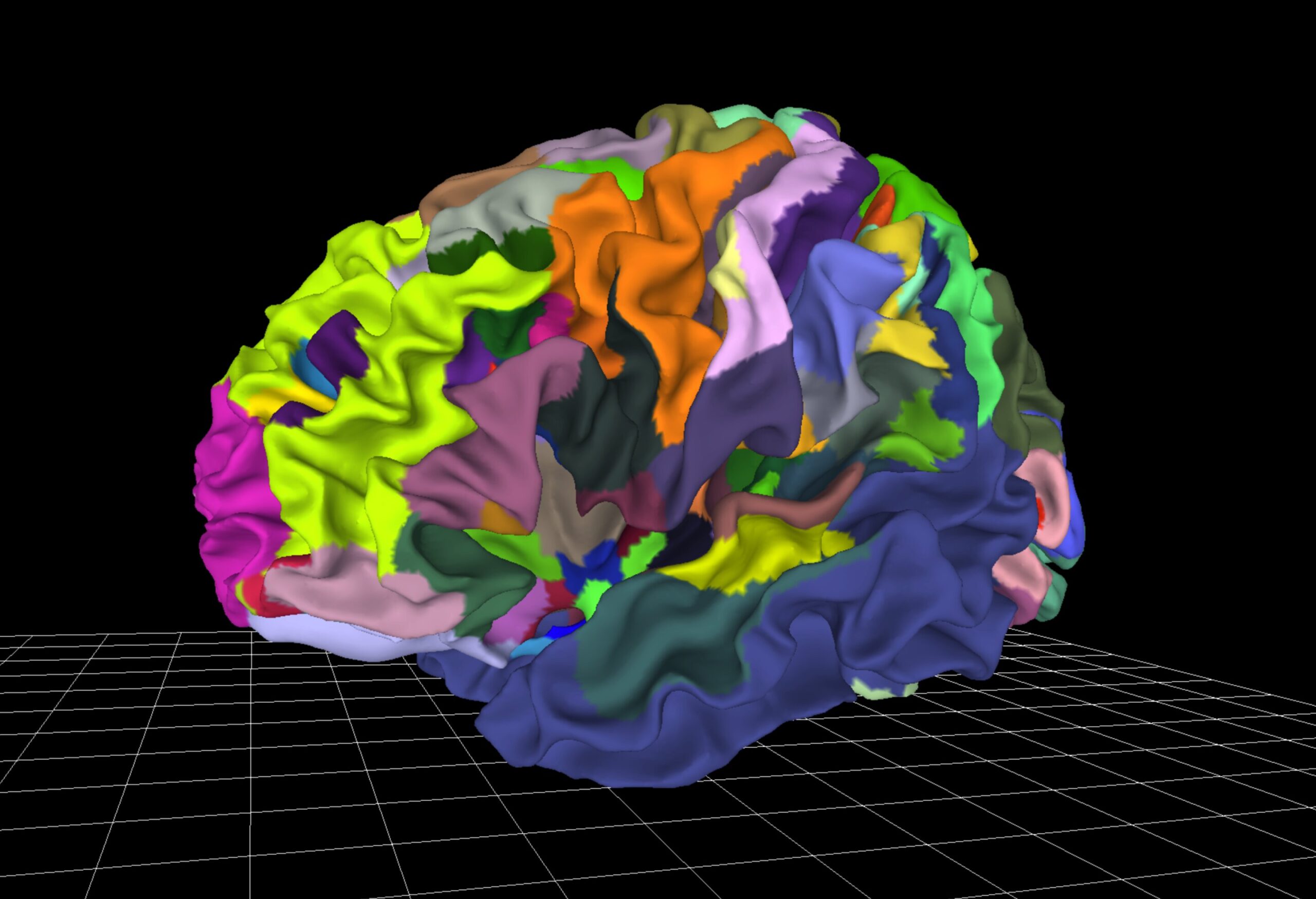 Atlas cerebral interactivo herramienta inexplorada en psiquiatría
