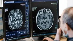 Inteligencia artificial en radiología para obtener respuestas médicas más eficientes