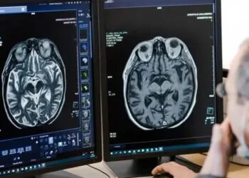 Inteligencia artificial en radiología para obtener respuestas médicas más eficientes